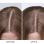 Traitement - Cuir chevelu sec 45ml