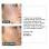 Clarity - Anti Blemish - 60/pack