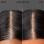 Scalp Vitality - Set